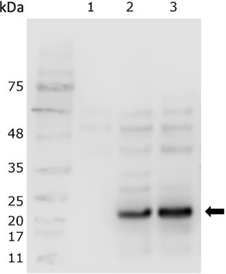 Oral Administration of Lactococcus lactis Producing Interferon Type II, Enhances the Immune Response Against Bacterial Pathogens in Rainbow Trout